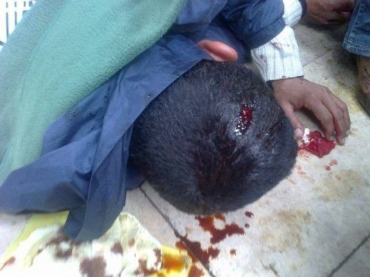 جرسيف : تعرض تلميذ بثانوية المسقبل لاعتداء بأسلوب داعشي يعرضه للخطر .