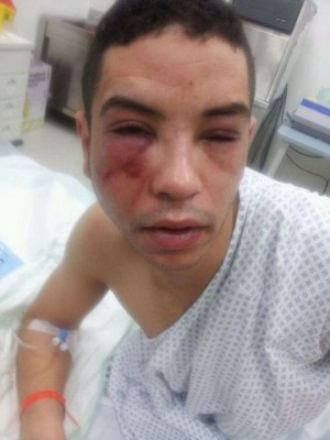 إيطاليا: قصة محاولة قتل شاب مغربي من طرف 4 عنصريين