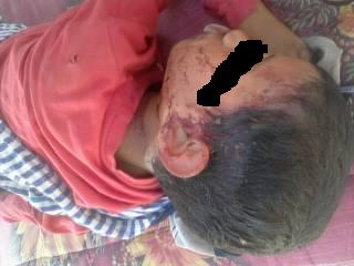 تاونات: حادثة سير،و الضحية تلميذين أخوين أحدهما في حالة خطيرة