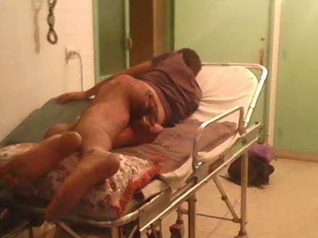 فاس: المستشفيين الجامعي و كوكار يرفضان تطبيب شاب من مرض جلدي غريب و خطير