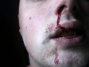 تازة: عون سلطة يتعرض لاعتداء من طرف بائع متجول