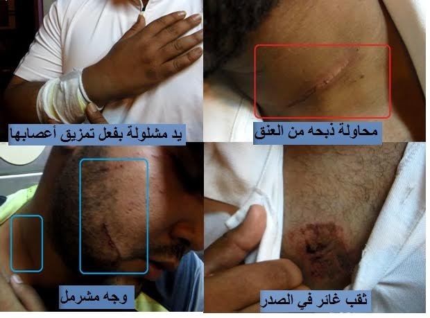 فاس:عصابة إجرامية مدججة بالأسلحة البيضاء والهراوات تشرمل مراقبي شركة سيتي باص