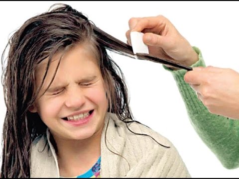 القمل الذي يصيب الأطفال…التعريف وطرق العلاج